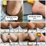 کرم اوره هانمی Hanmi Urea Hand&Foot Cream - تصویر 2